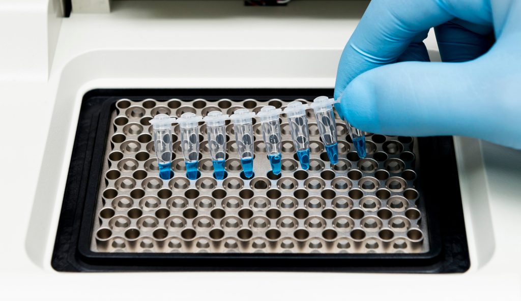 The Future of PCR Testing